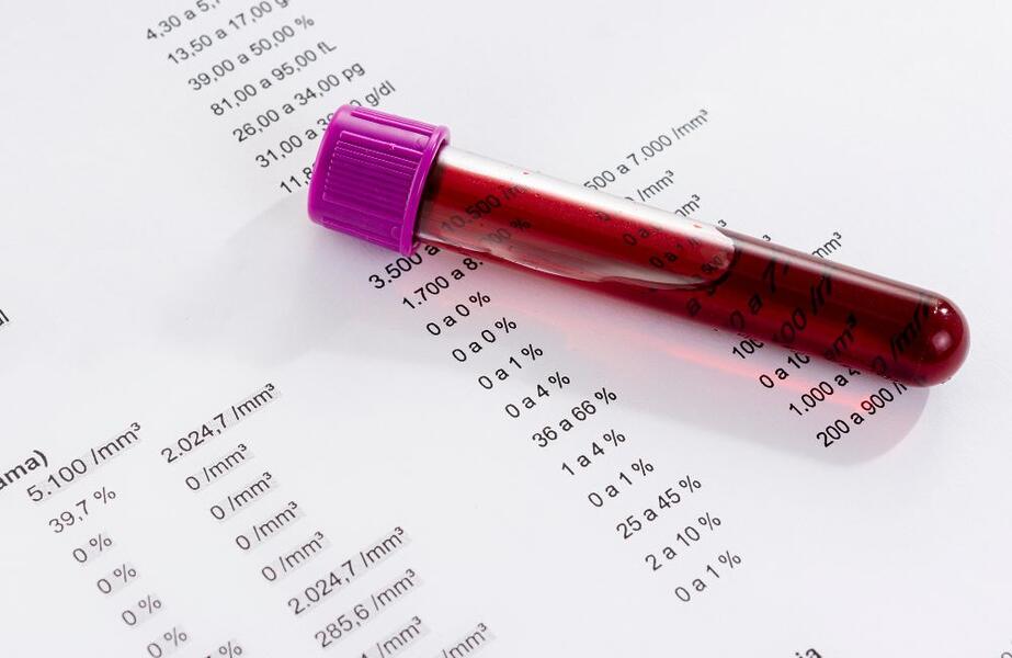 para que serve o hemograma, hemograma valores de referência, hemácias leucócitos plaquetas, exame de sangue de rotina